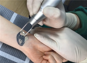 黑色紋身好洗嗎？